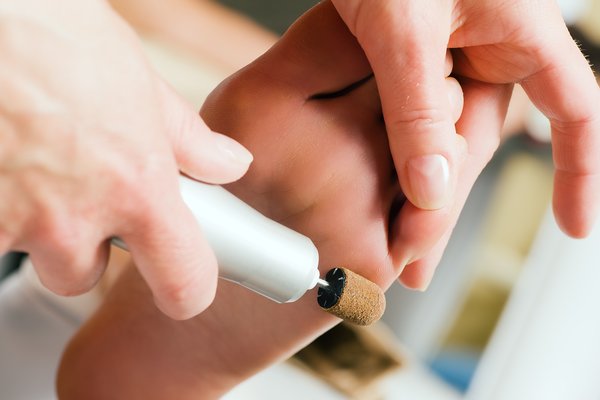 need for a podiatrist