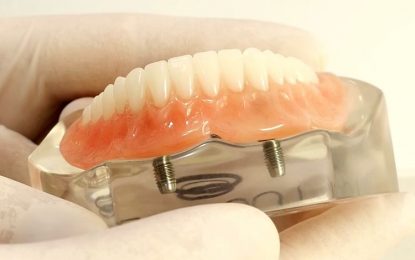Six Major Benefits of Dentures