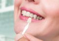 Everything You Wanted To Know About Dental Veneers!