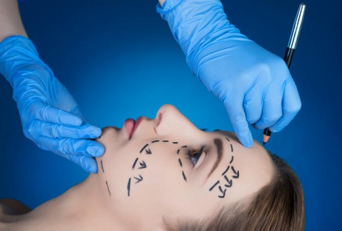 Common Questions About Facelift Procedures